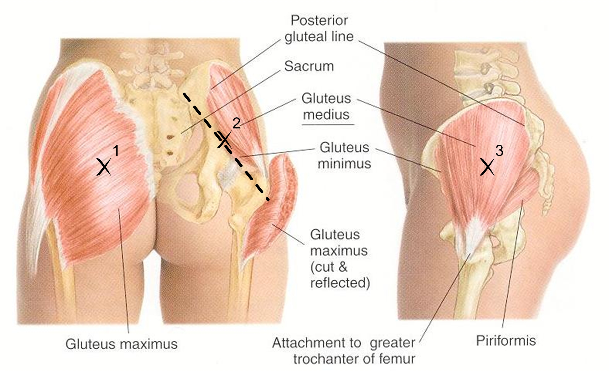 3 types of gluteal muscles