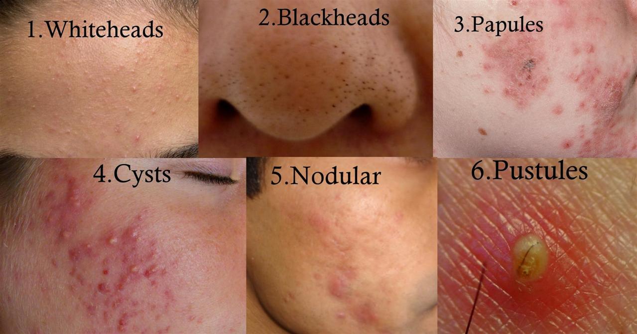 itchy scalp and rash on back of neck - Dermatology - MedHelp