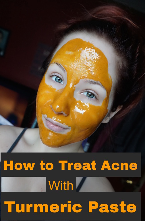 How to Treat Acne Effectively with Turmeric