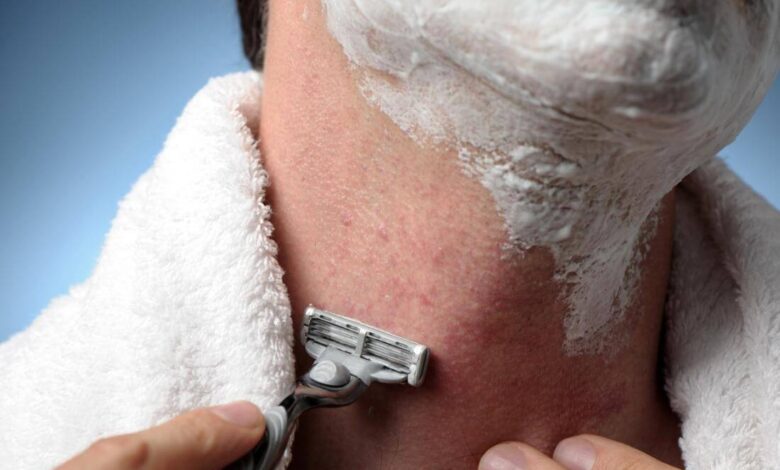 get rid of razor bumps fast