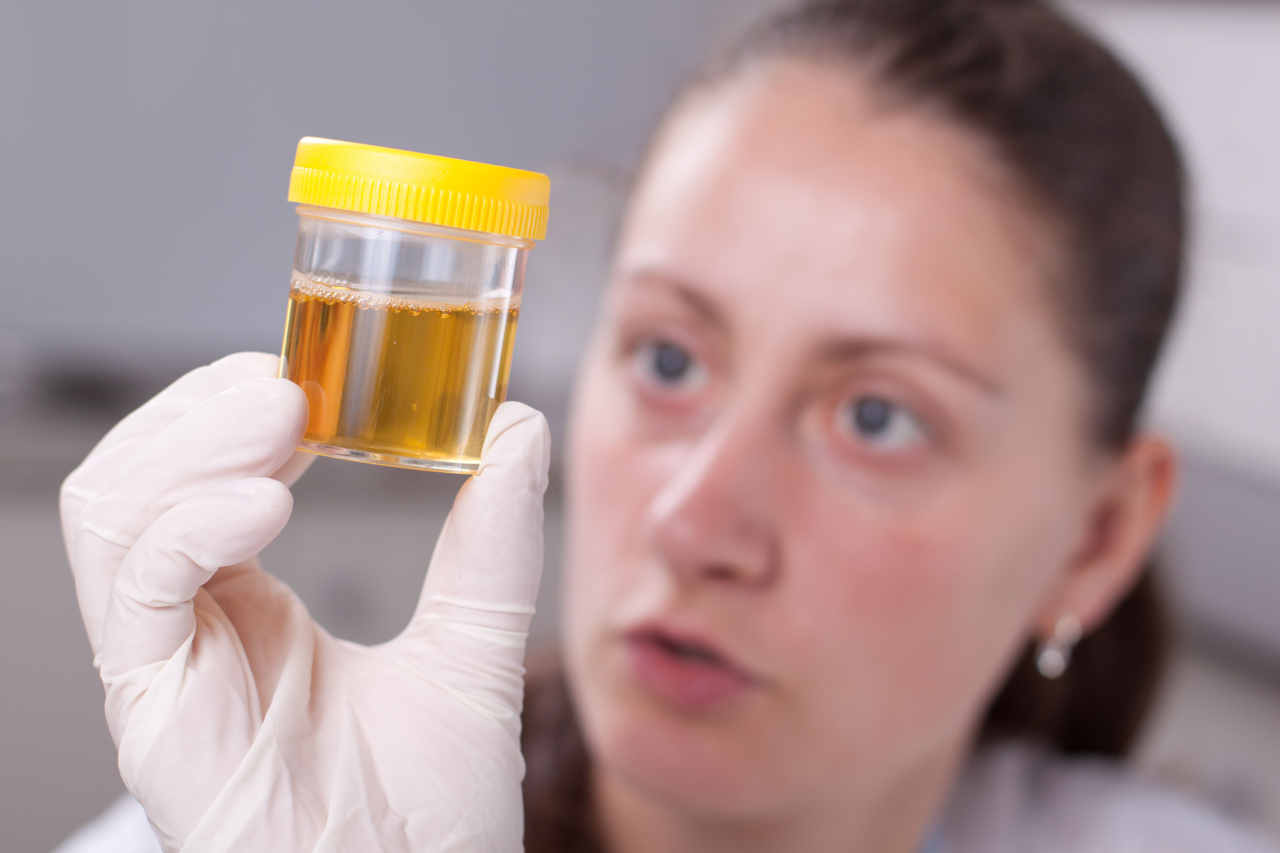 How long does alcohol stay in your urine