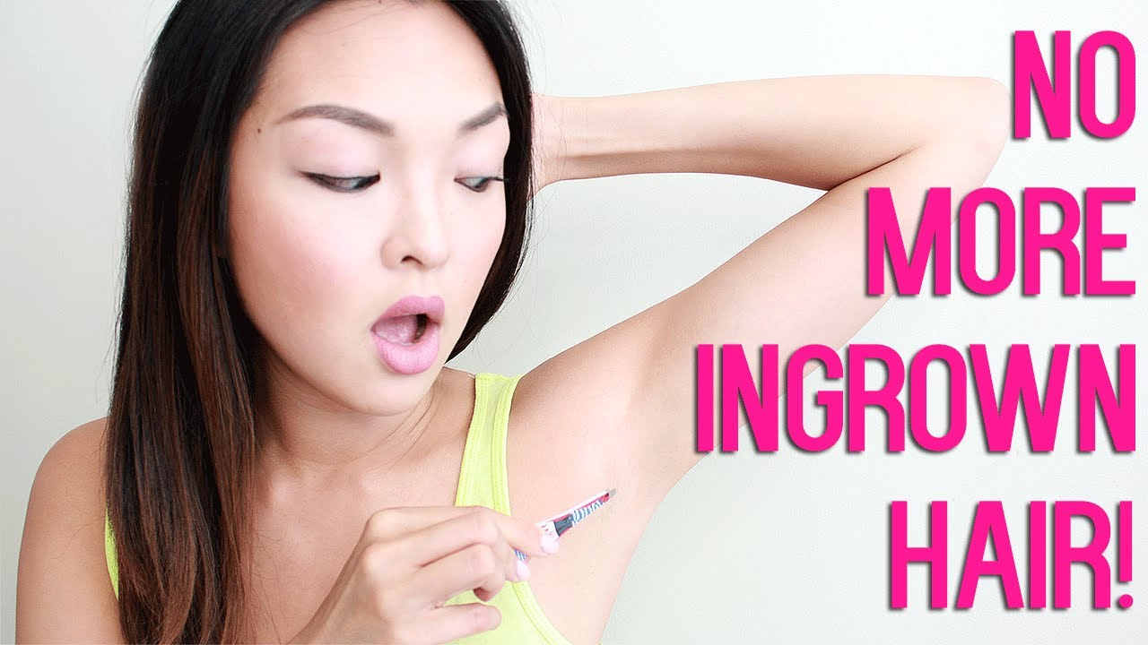 How To Get Rid Of Ingrown Hair Quickly And Safely