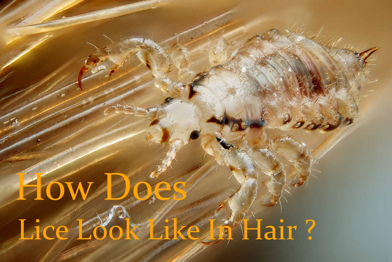 What Does Lice Look Like In Hair
