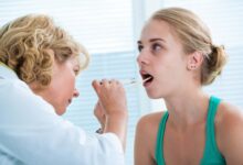 Home Remedies for Tonsil Stones