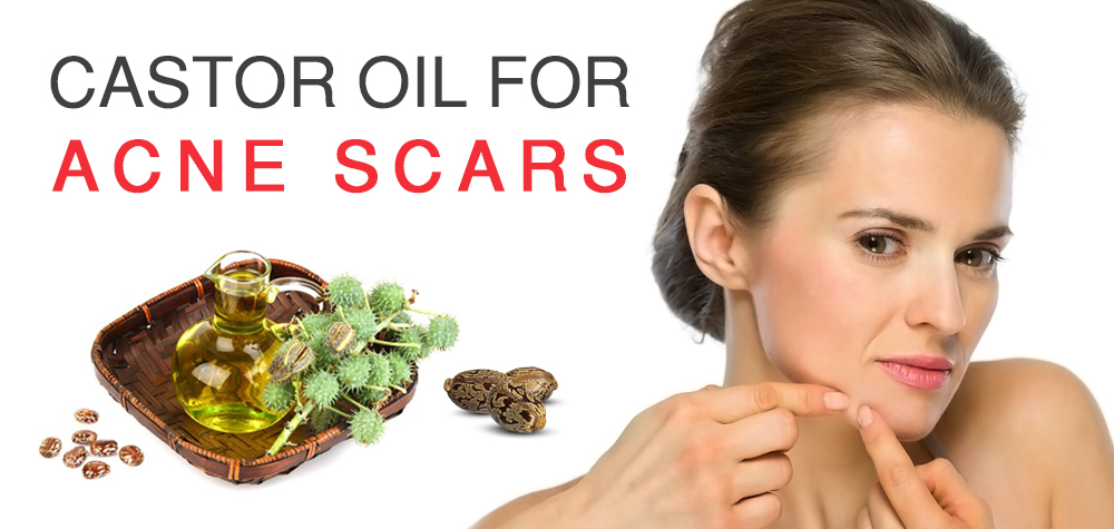 Castor Oil for Acne Scars