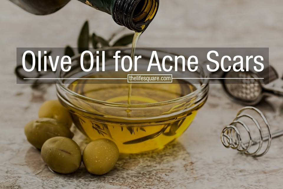 Olive Oil for Acne Scars