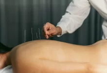 Acupuncture For Weight Loss