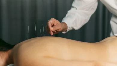 Acupuncture For Weight Loss