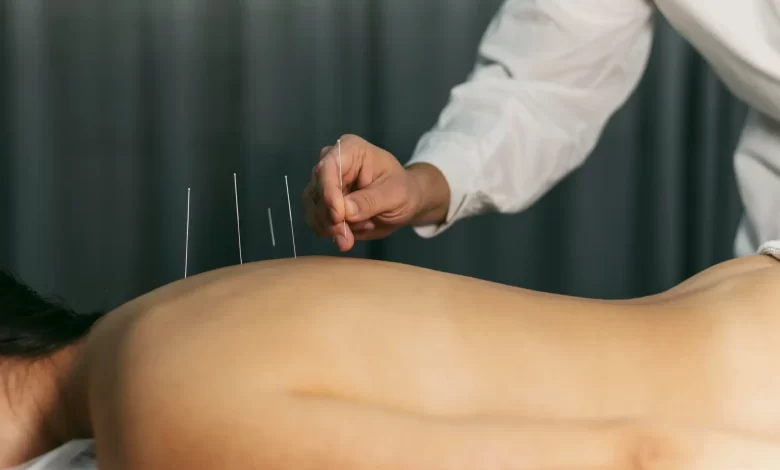 Acupuncture For Weight Loss